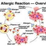 Οι αλλεργίες της άνοιξης
